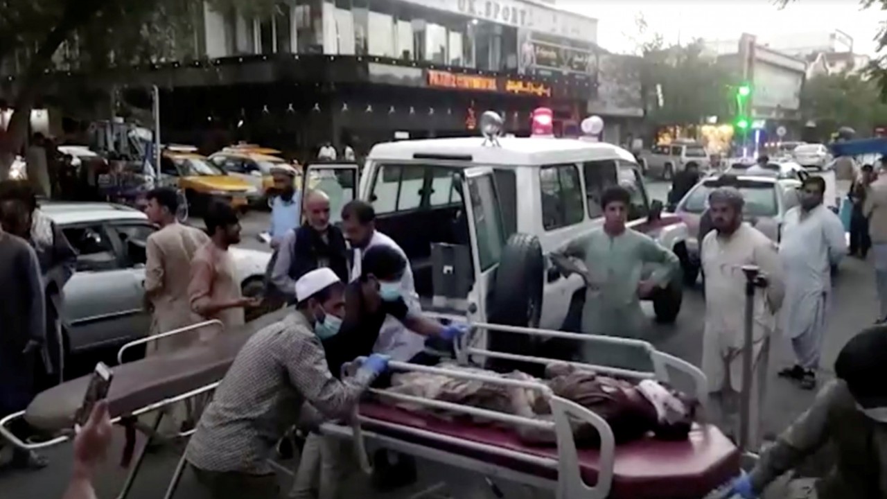19 orang tewas akibat ledakan di rumah sakit militer di Kabul/ist