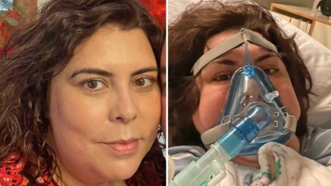 Monica Almeida sembuh dari koma akibat Covid-19 setelah mengonsumsi pil Viagra. (News.com.au)