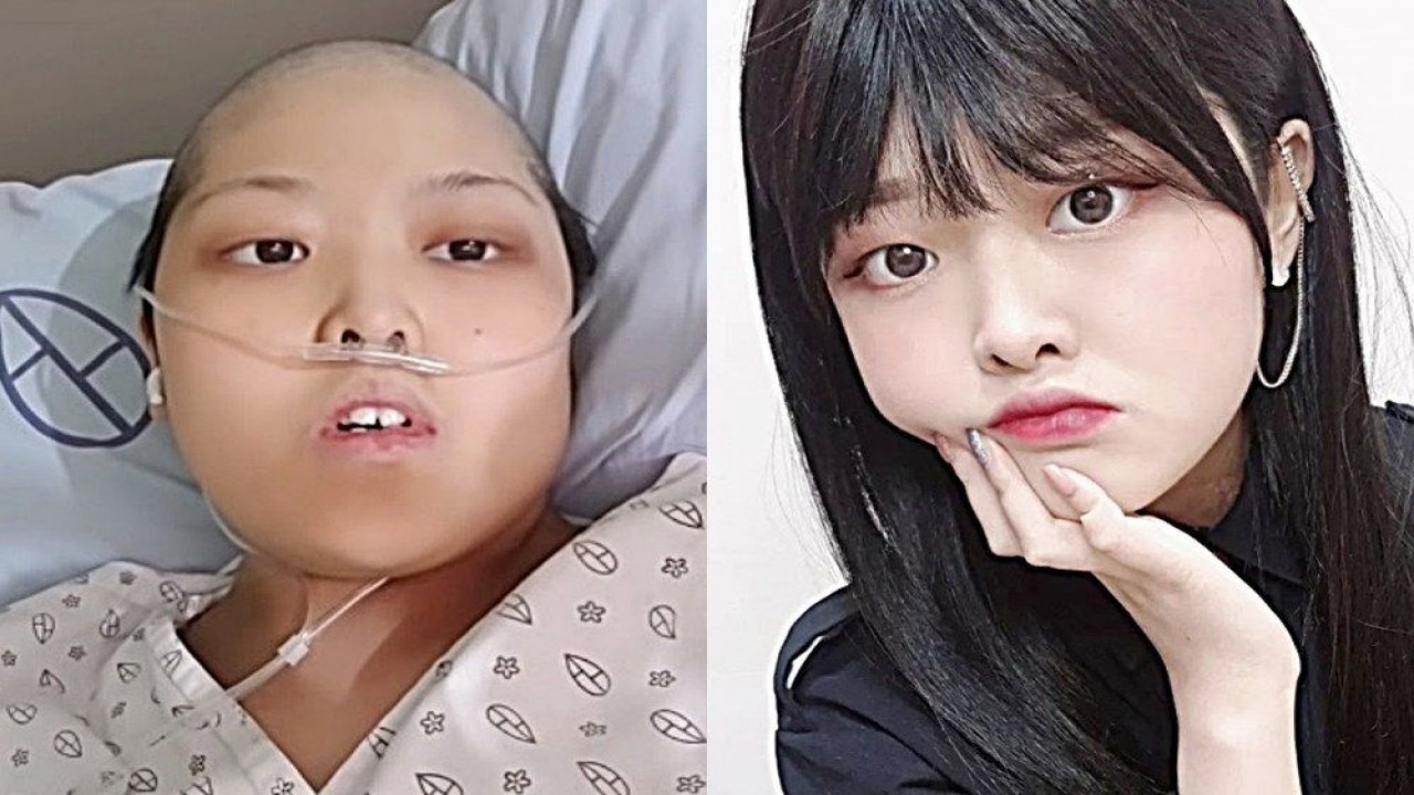 YouTuber asal Korsel Kkuming didiagnosis menderita kanker ovarium stadium 4 pada 2020 di usia 21 tahun. (Allkpop)