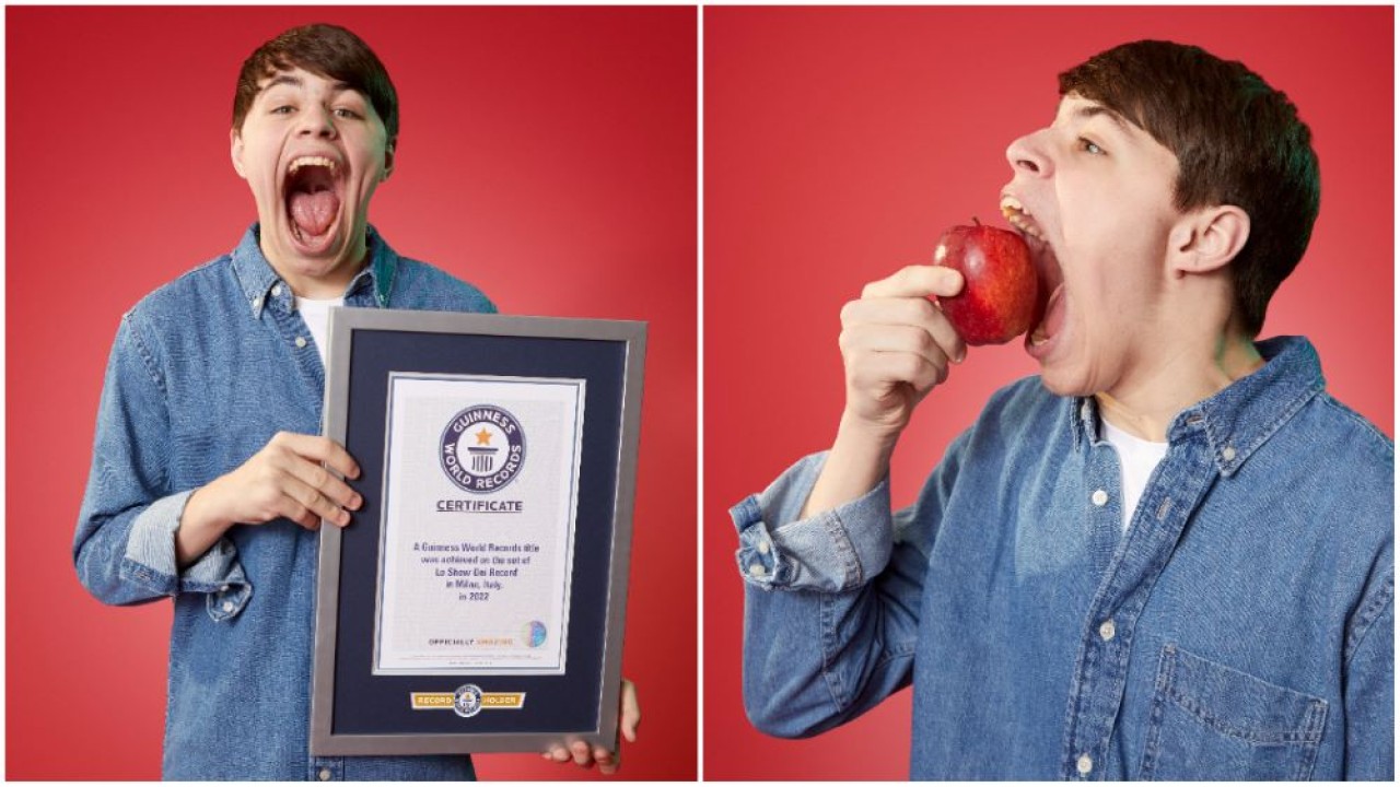 Isaac Johnson, remaja asal Minnesota, AS, mencetak rekor Guinness World Records dengan mulut terbesar di dunia. (Guinness World Records)