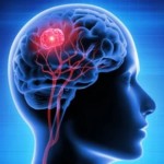 Ilustrasi tumor otak (ANTARA/Shutterstock)-1672823877