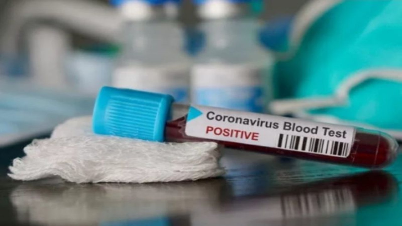 Ilustrasi - Sample darah yang terindikasi positif Virus Corona. (ANTARA/Shutterstock/am)