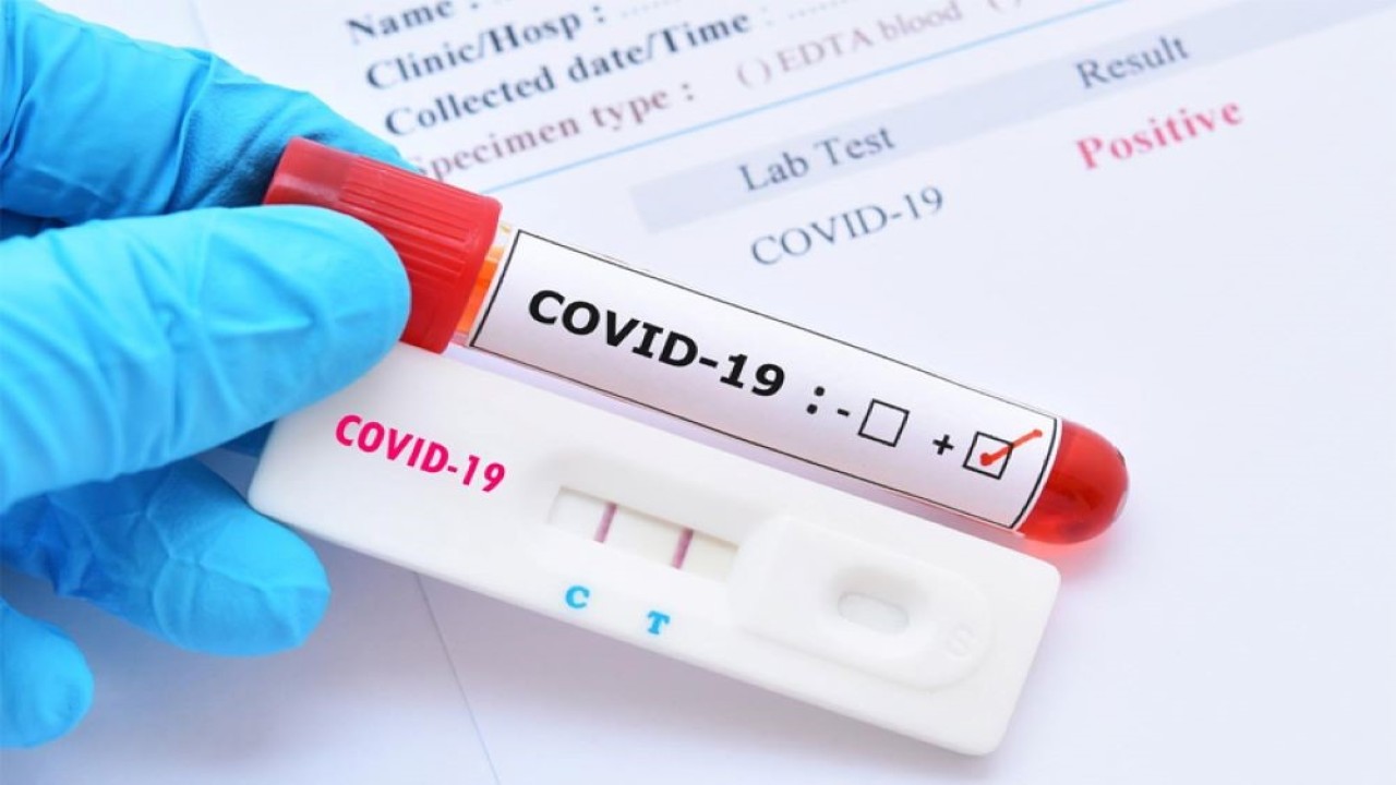 Ilustrasi. Varian baru virus Covid-19 yang ada saat ini tidak mengubah tingkat keparahan penyakitnya. (Istimewa) 
