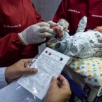 Dokter: Hipotiroid kongenital tidak bergejala saat bayi lahir-1695011604