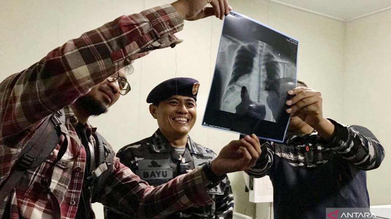 Komandan KRI dr. Radjiman Wedyodiningrat-992 Kolonel Laut (P) Bayu Dwi Wicaksono (tengah) melihat hasil rontgen dada (foto thorax) yang merupakan salah satu layanan kesehatan di KRI dr. Radjiman, Jakarta, Kamis (30/11/2023). ANTARA/Genta Tenri Mawangi.
