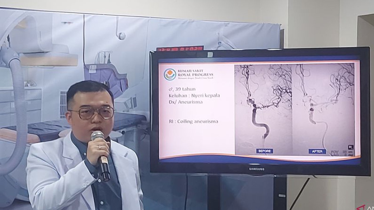 Dokter Spesialis Radiologi lulusan Universitas Hasanuddin dr. Kevin Julius Tanady, Sp.Rad, Subsp.RI (K), Kamis (29/2/2024) memperkenalkan manfaat dari salah satu teknologi radiologi intervensi yang diberi nama ‘Digital Subtraction Angiography’ (DSA) kepada awak media. (ANTARA/Abdu Faisal)