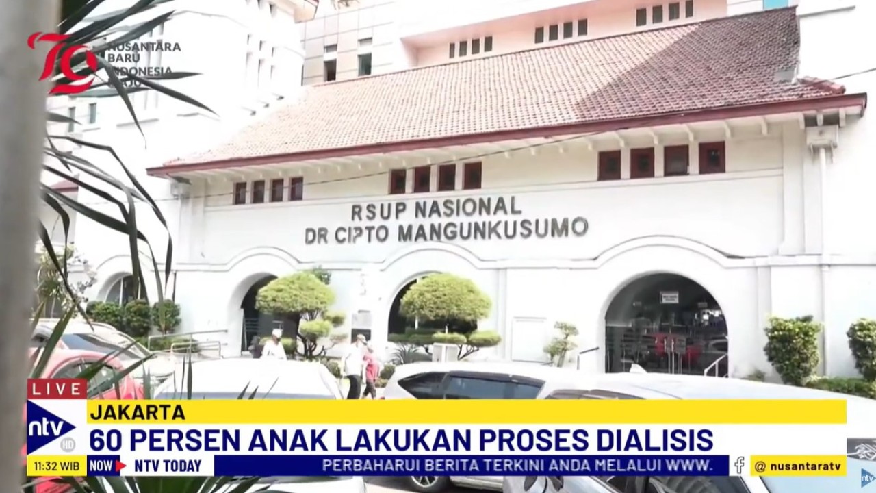 Ketua Pengurus Pusat Ikatan Dokter Anak Indonesia (IDAI) dr. Piprim Basarah Yanuarso mengatakan RSCM memiliki unit dialisis khusus anak-anak.