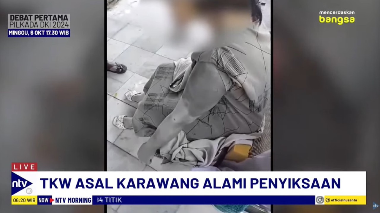 Nurlela, TKW asal Karawang, mengalami penyiksaan sadis di Arab Saudi.