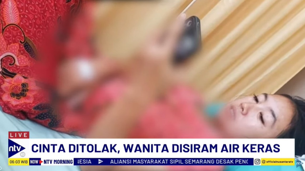 Seorang wanita bernama Farah Rizka (20) menjadi korban penyiraman air keras di Bekasi.