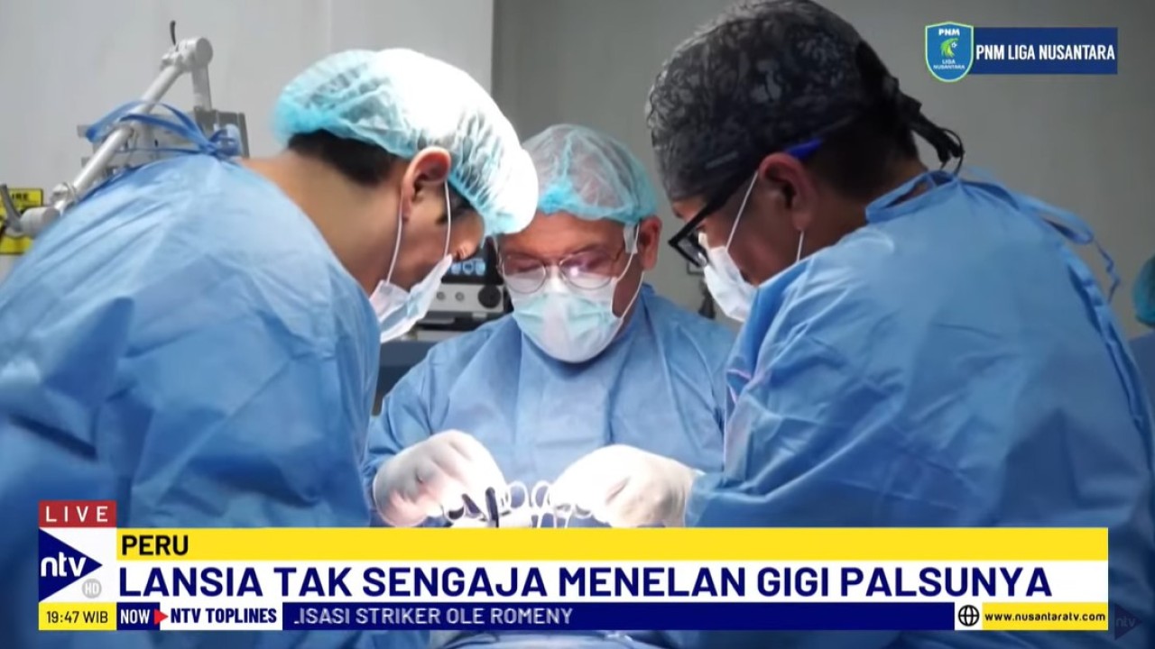 Seorang pria berusia 81 tahun dari Peru secara tidak sengaja menelan gigi palsunya saat mengalami serangan epilepsi.