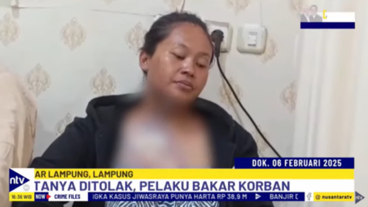 Korban Tri Wulandari mengalami luka bakar serius dan harus mendapat perawatan medis