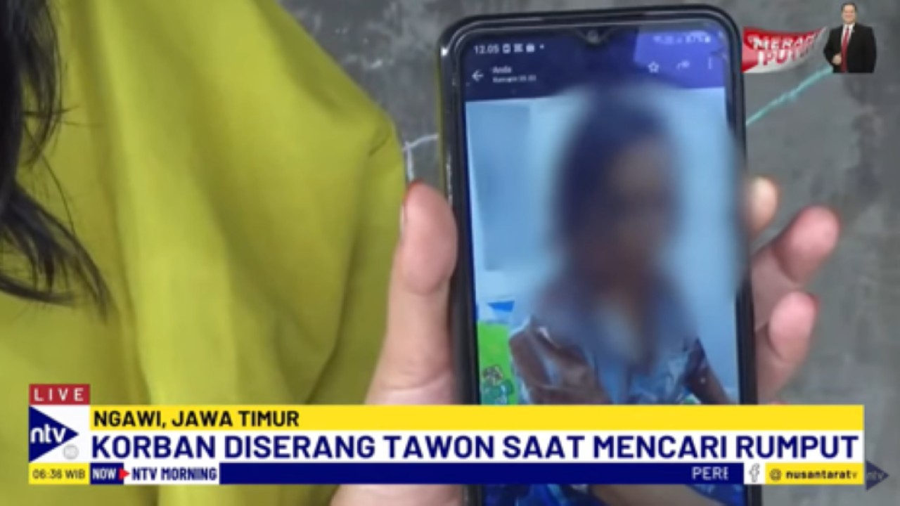 Anak korban memperlihatkan kondisi ibunya saat masih dirawat di rumah sakit setelah disengat ratusan tawon vespa