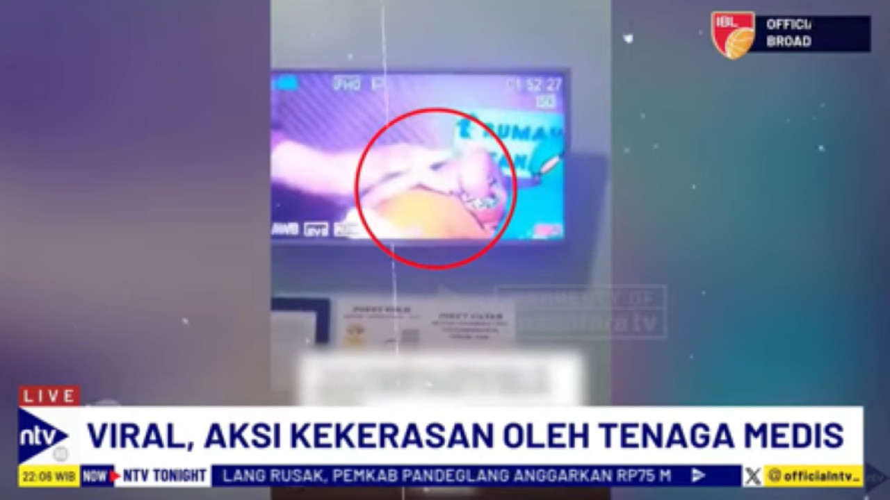 Seorang dokter di Cianjur terekam kamera CCTV melakukan kekerasan terhadap seorang pasien anak yang sedang sunat